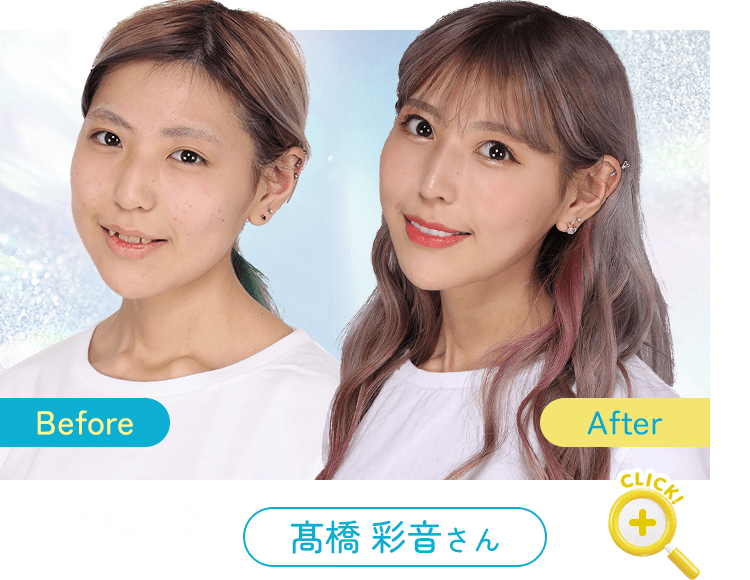Before After 症例3