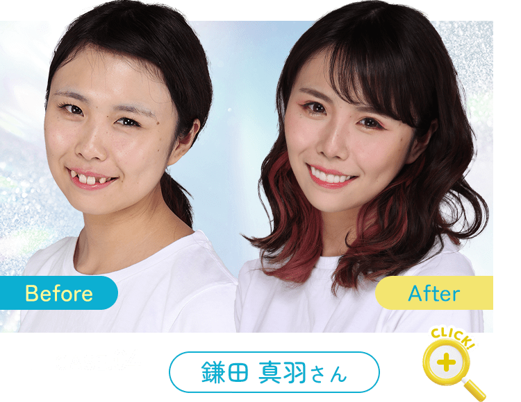 Before After 症例4