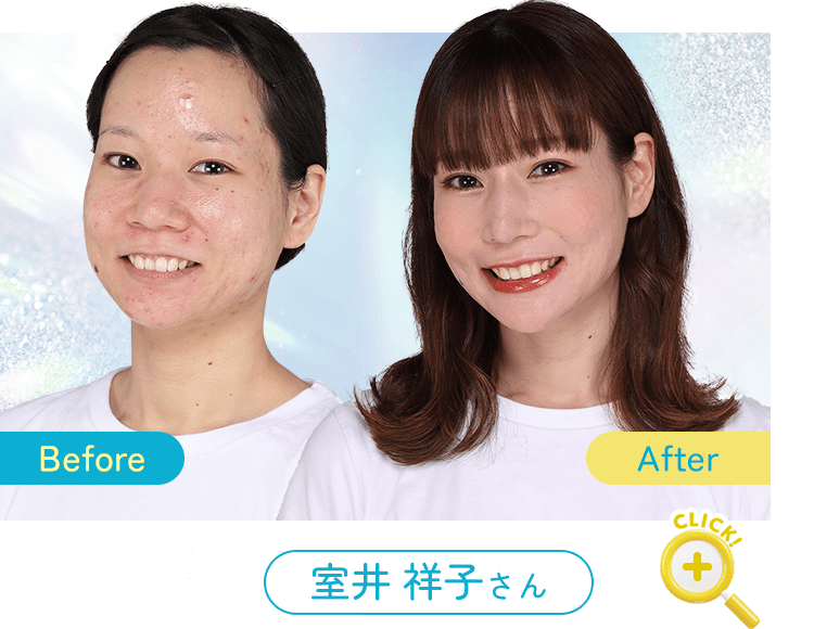 Before After 症例5