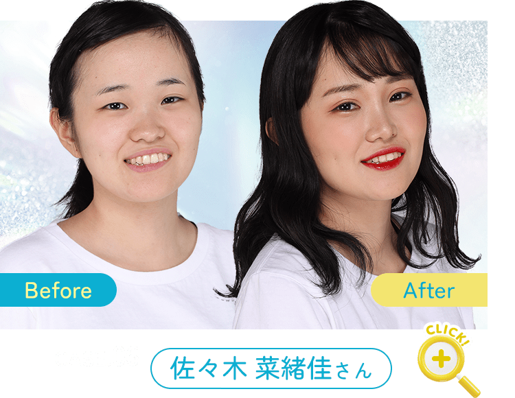 Before After 症例6