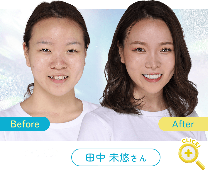 Before After 症例7