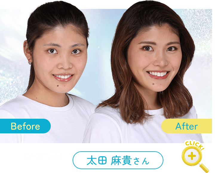 Before After 症例8