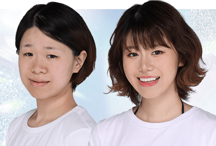 Before After 症例2