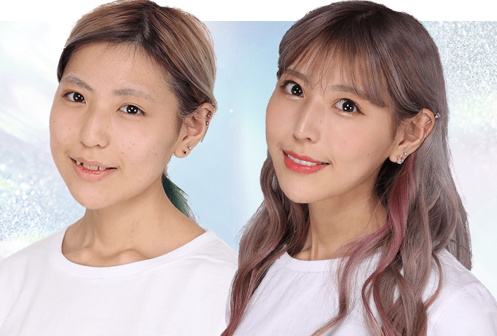 Before After 症例3
