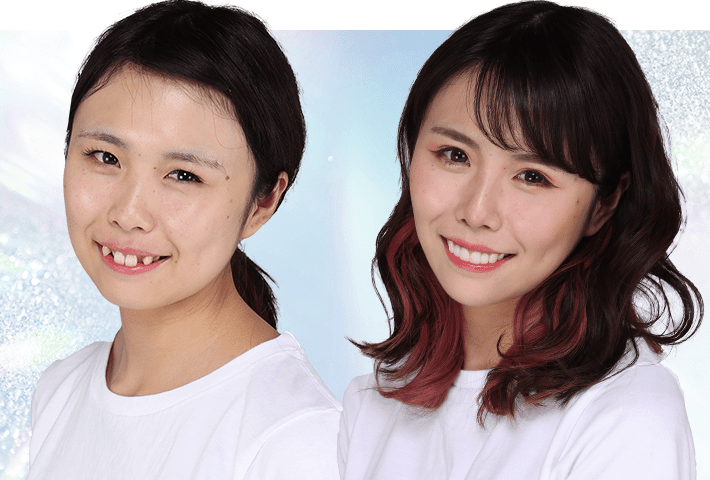 Before After 症例4