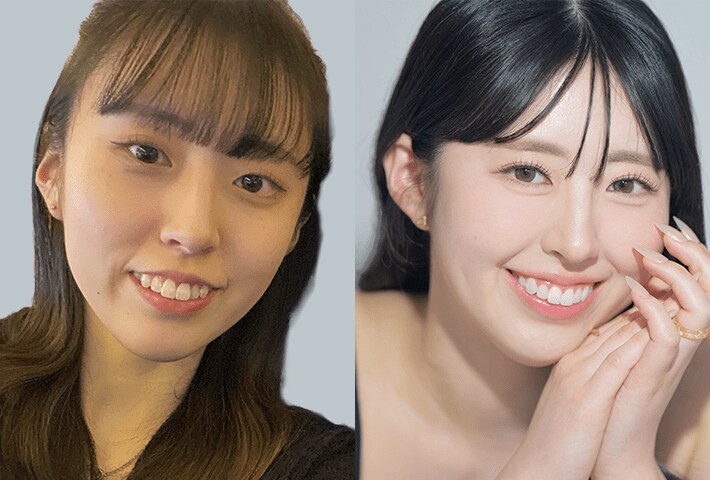 Before After 症例7