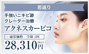 アクネスカーピコ