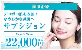 サブシジョン