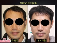 今月のベスト症例写真