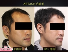 今月のベスト症例写真