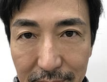 今月のベスト症例写真