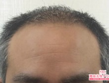 今月のベスト症例写真