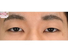 今月のベスト症例写真