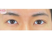 今月のベスト症例写真