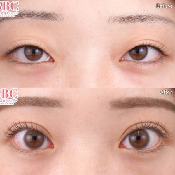 多田 彩子 症例写真