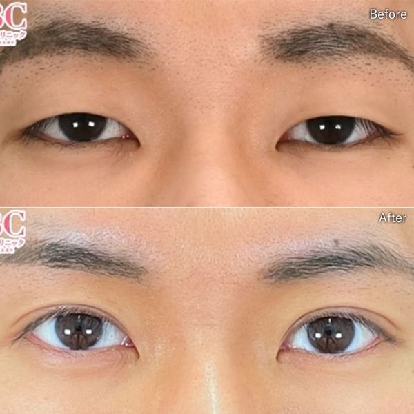 岩本優輝 症例写真