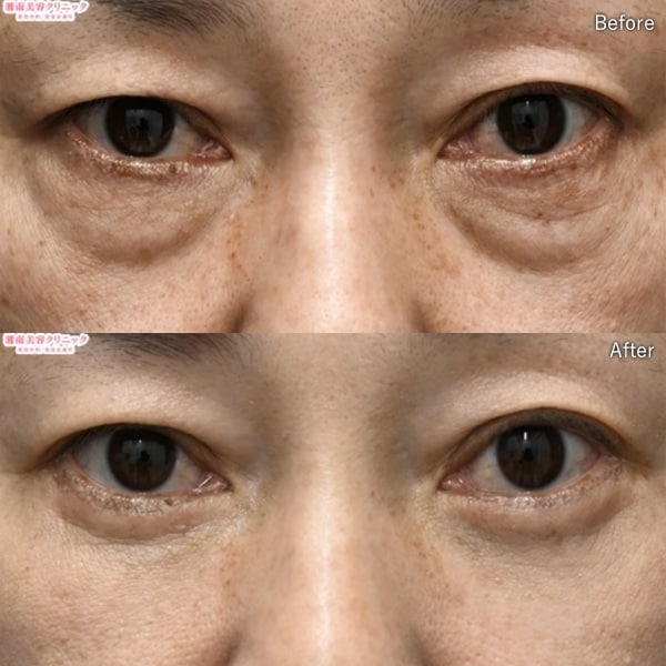 中野達生医師 症例写真