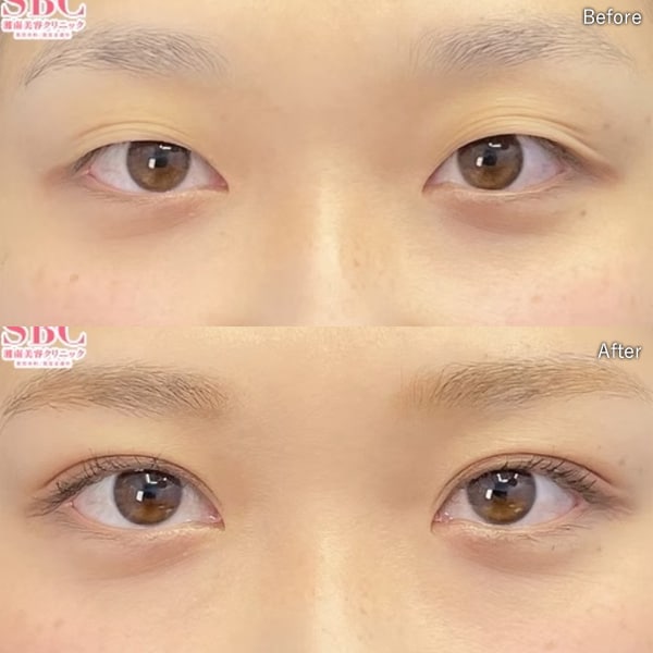 岩本理雨医師 症例写真