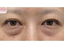 今月のベスト症例写真