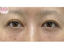 今月のベスト症例写真