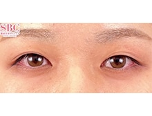 今月のベスト症例写真