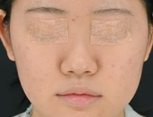 今月のベスト症例写真