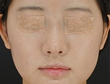 今月のベスト症例写真