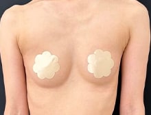 今月のベスト症例写真