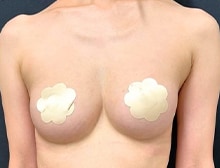 今月のベスト症例写真