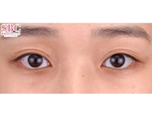 今月のベスト症例写真