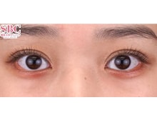 今月のベスト症例写真