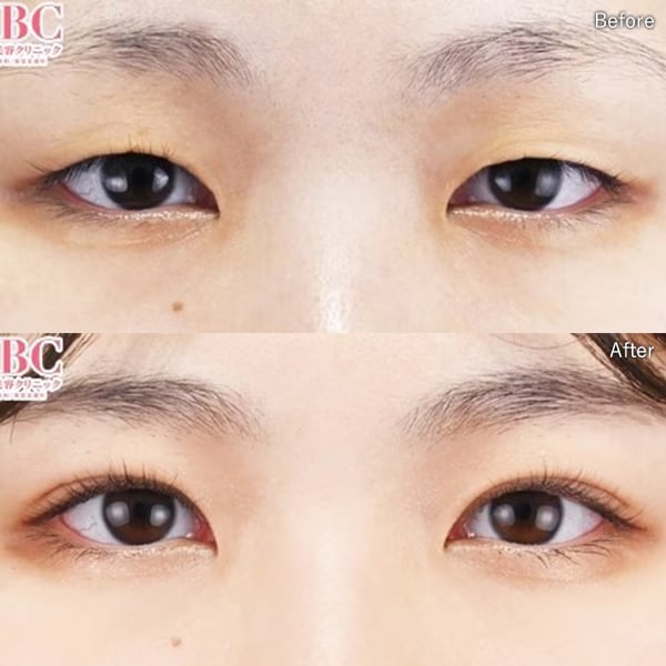 中谷 拓医師 症例写真