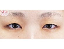 今月のベスト症例写真