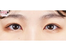 今月のベスト症例写真