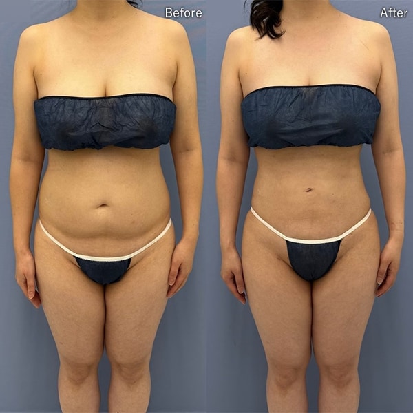 葛島 魁人医師 症例写真