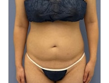 今月のベスト症例写真