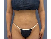 今月のベスト症例写真