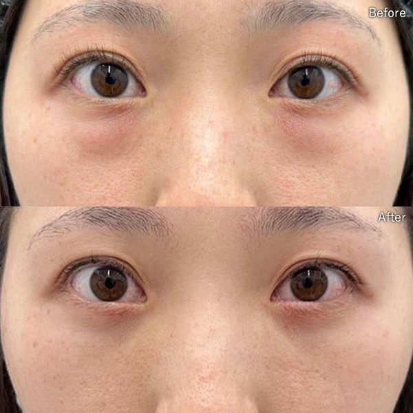 櫻井 将継医師 症例写真