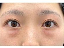 今月のベスト症例写真