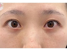 今月のベスト症例写真