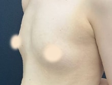 今月のベスト症例写真