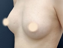 今月のベスト症例写真