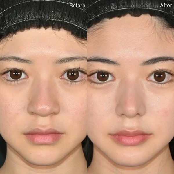 中野 達生医師 症例写真