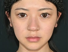 今月のベスト症例写真