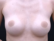 今月のベスト症例写真