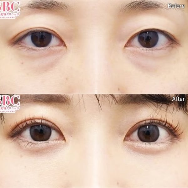 中谷 拓医師 症例写真