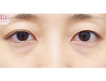 今月のベスト症例写真