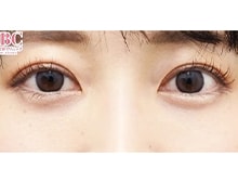 今月のベスト症例写真