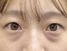 今月のベスト症例写真