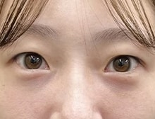 今月のベスト症例写真